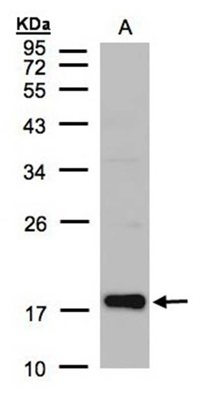 Cofilin 2 antibody