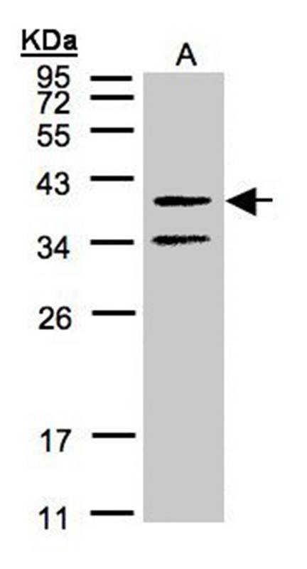 galanin receptor 2 antibody