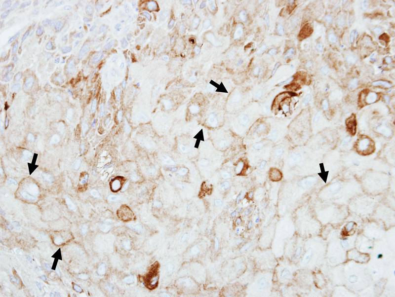 GIPC1 antibody