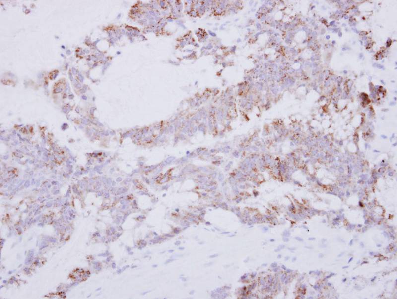 GRAP2 antibody
