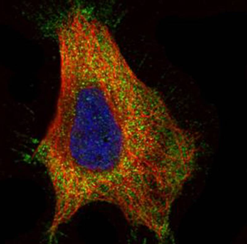 GAD65 antibody