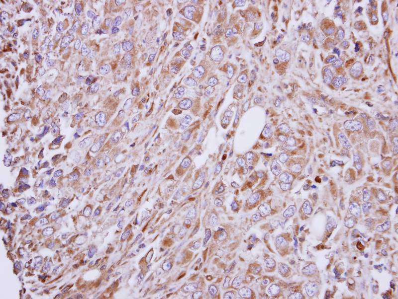 GAD65 antibody