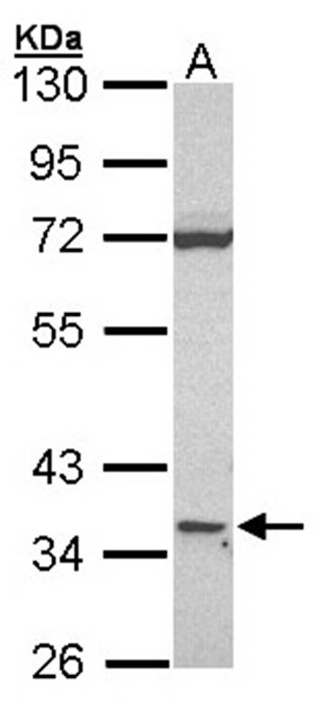 CD1D antibody