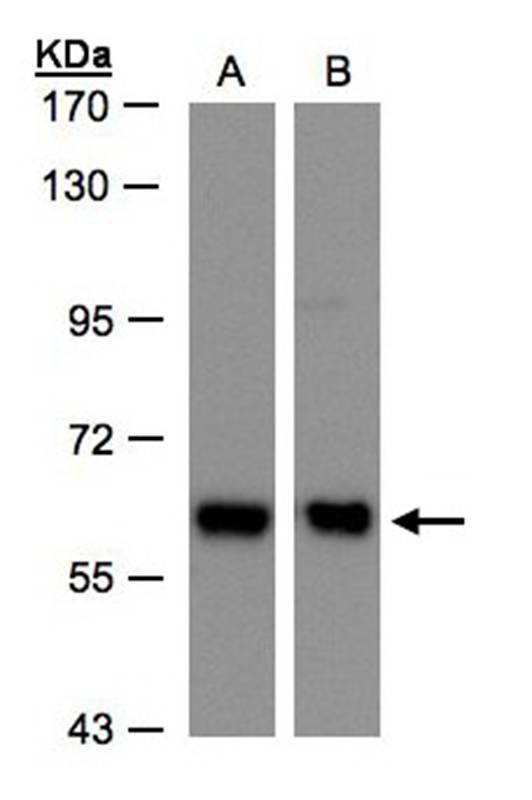 COPD antibody