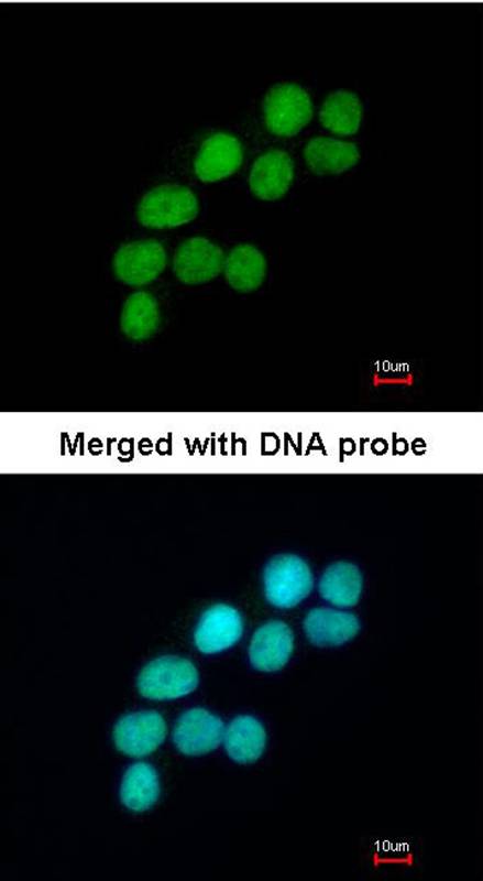 DNA ligase 3 antibody
