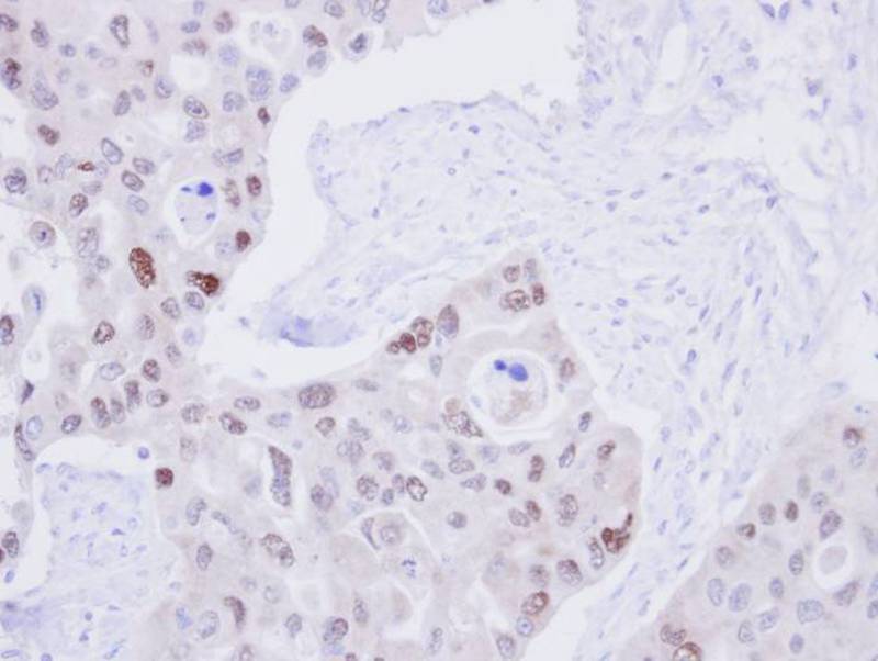 DNA ligase 3 antibody