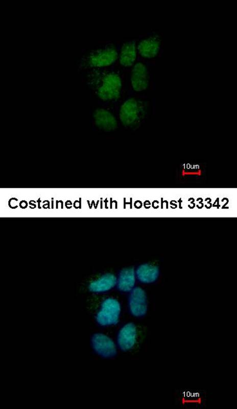 NR0B2 antibody