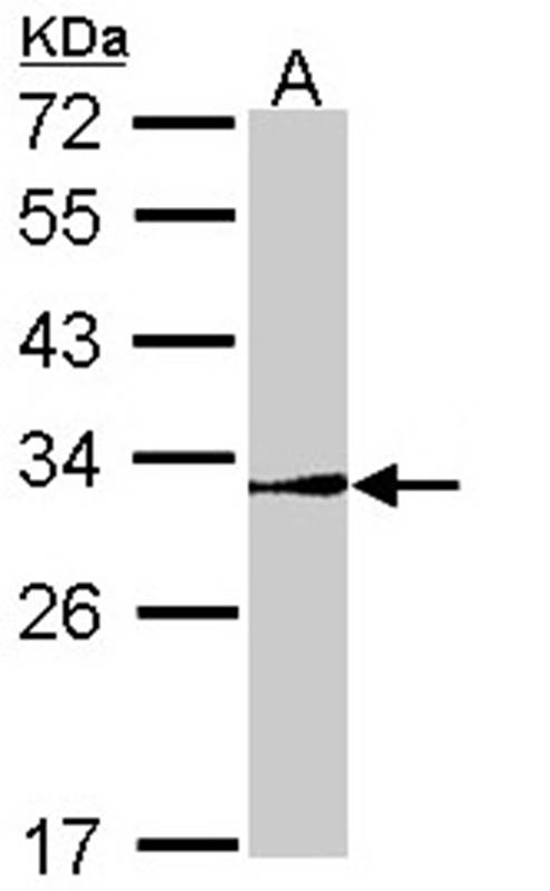 NR0B2 antibody