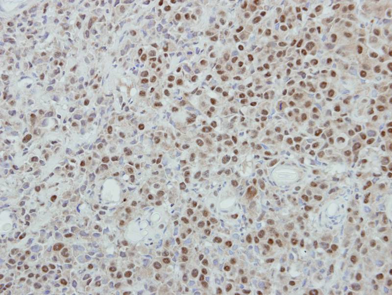 p84 antibody