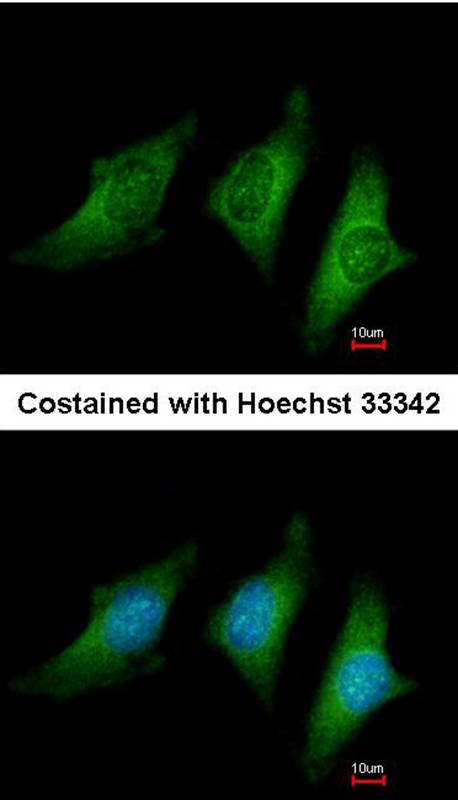 CD55 antibody