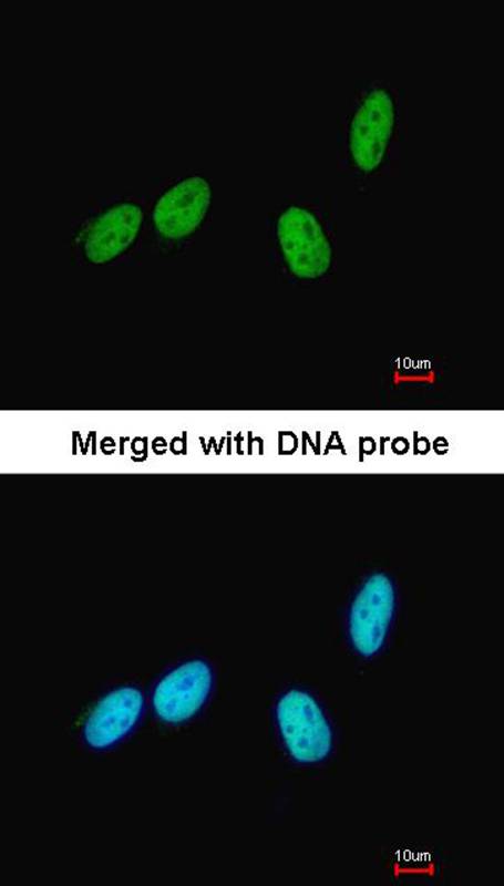 RED antibody