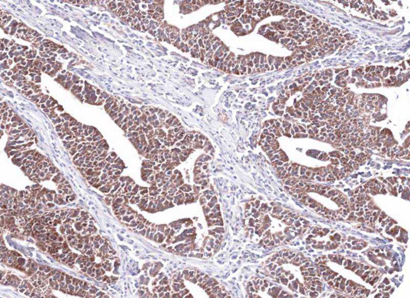 PCCase beta antibody