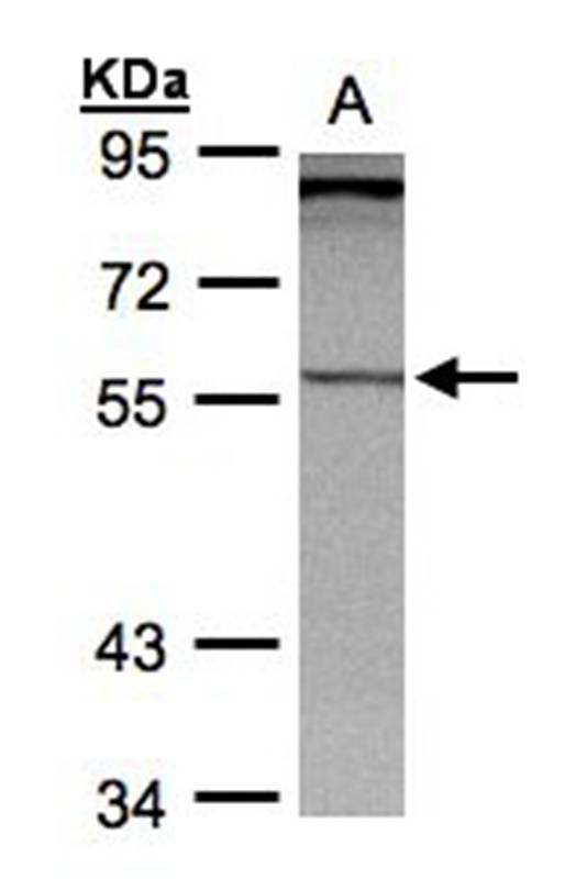 PCCase beta antibody
