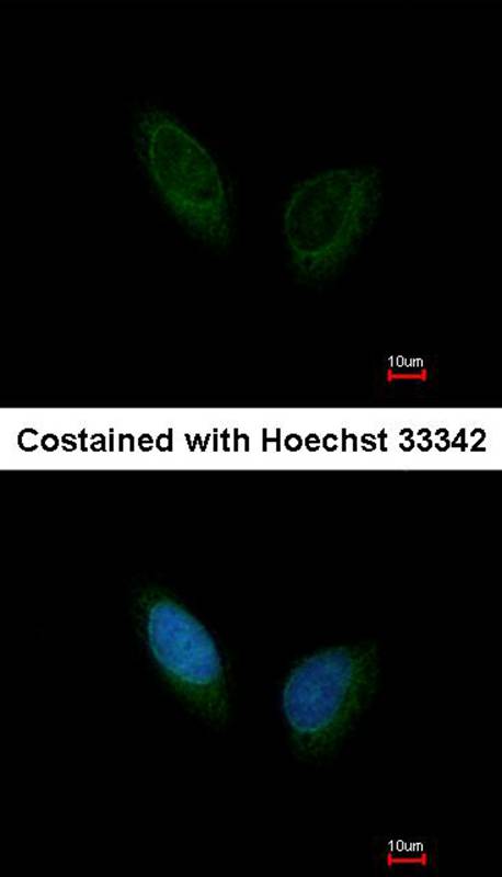 PHKA1 antibody