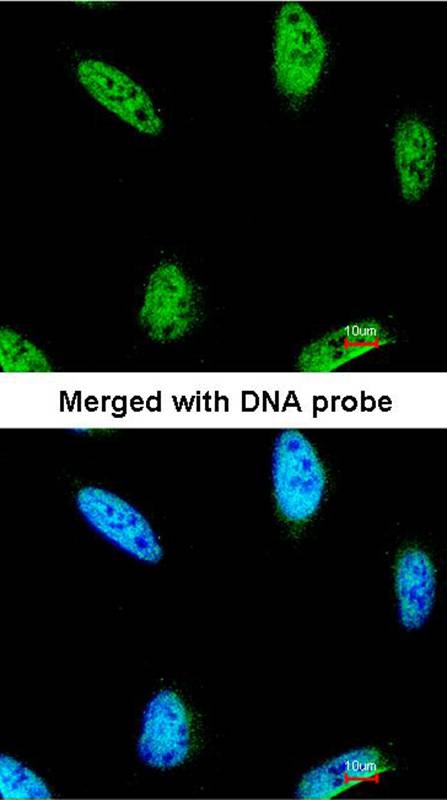 IPMK antibody