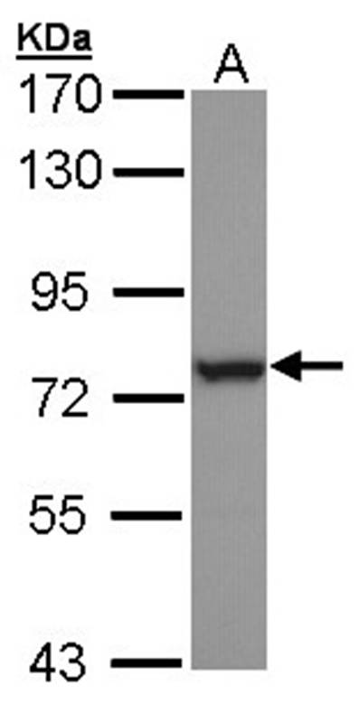 HSPA6 antibody