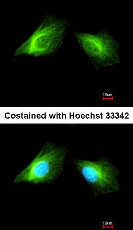 Histamine H2 Receptor antibody