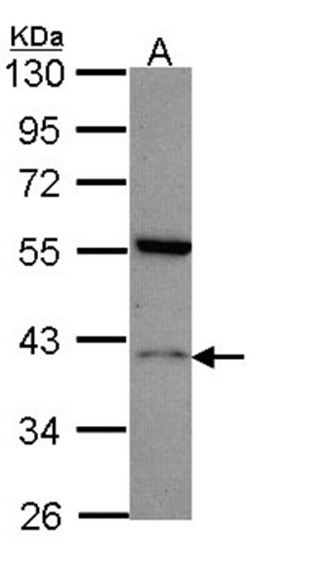 Histamine H2 Receptor antibody