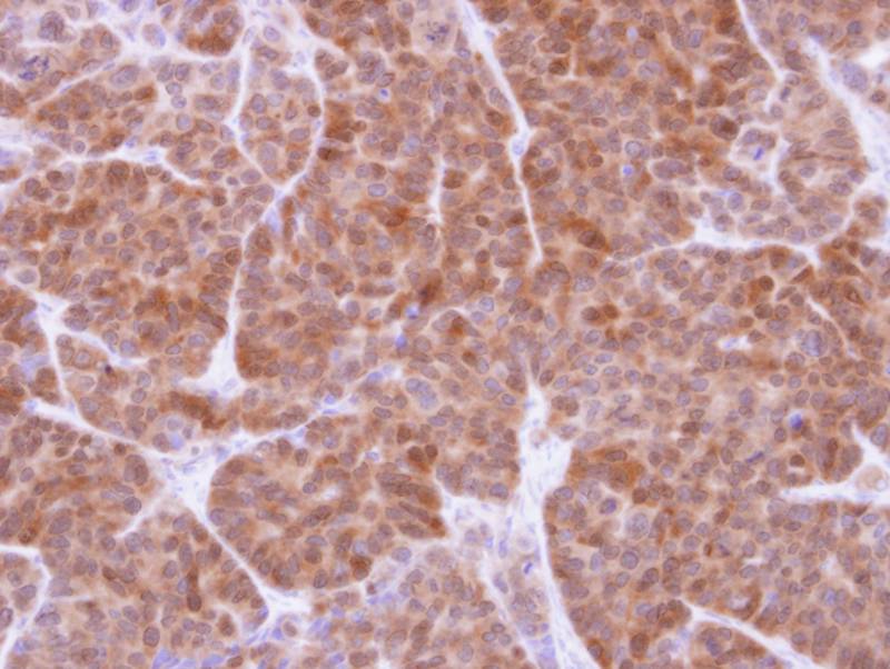 GSTT1 antibody
