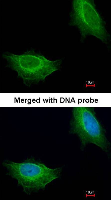 ADCK1 antibody