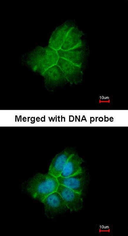 Collagen I alpha2 antibody