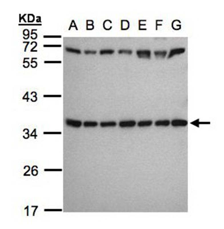 ribosomal protein S3a antibody