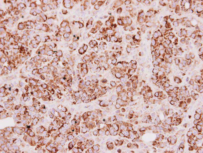 Rhodanese antibody