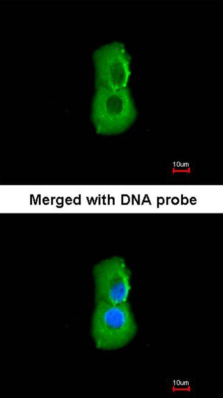 PSMC3 antibody