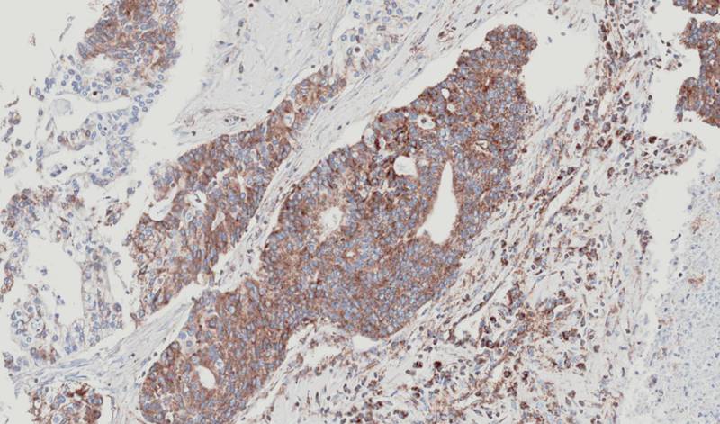 NDUFS4 antibody