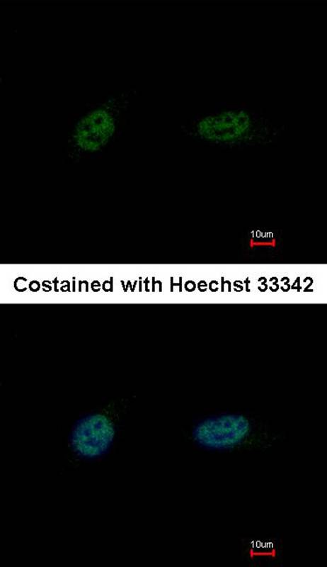 PARP3 antibody