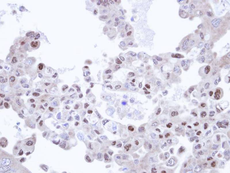 TRIM32 antibody