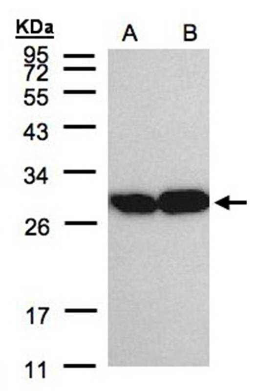 TPI1 antibody