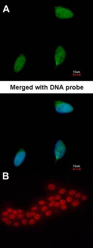 ERG antibody
