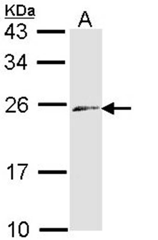 ET-3 antibody