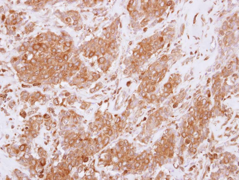 RGS10 antibody