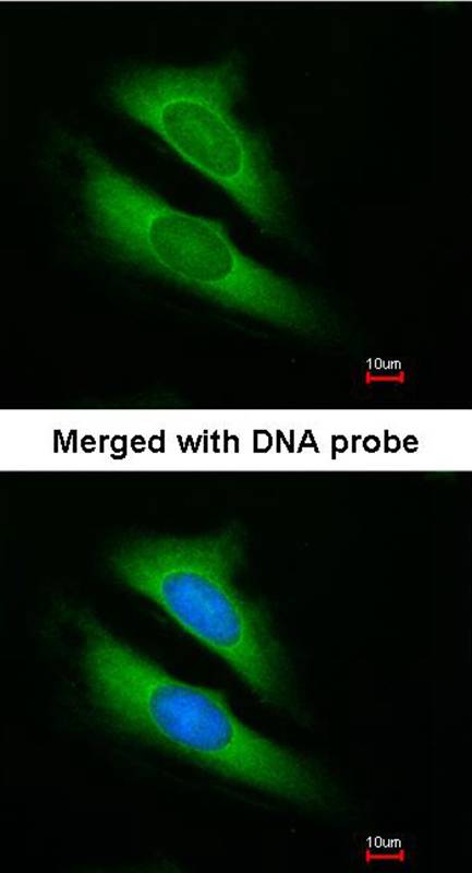 ATIC antibody