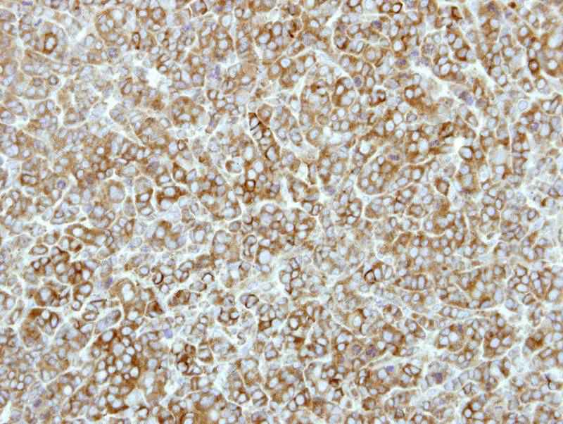 EEF2K antibody