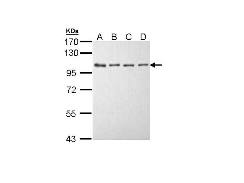 EEF2K antibody