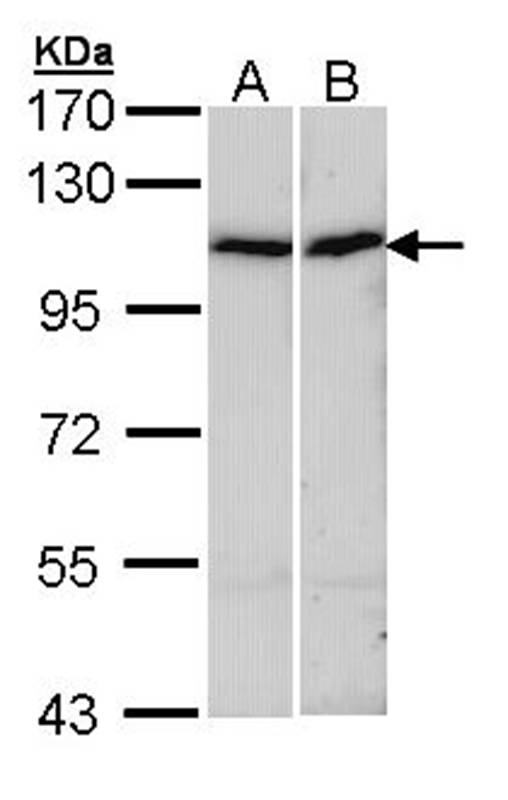 alpha Actinin 4 antibody