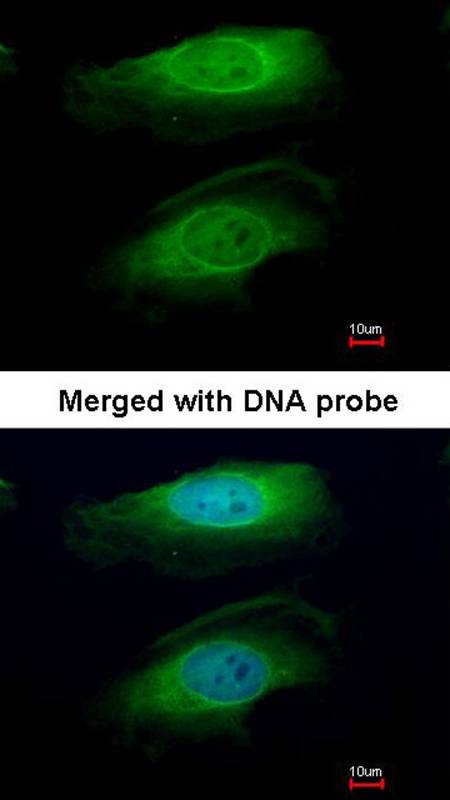 RICTOR antibody