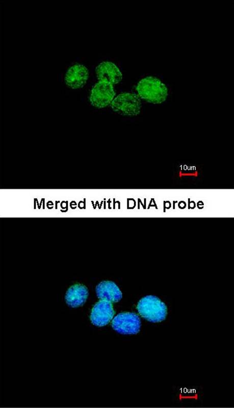 ERCC8(CSA) antibody