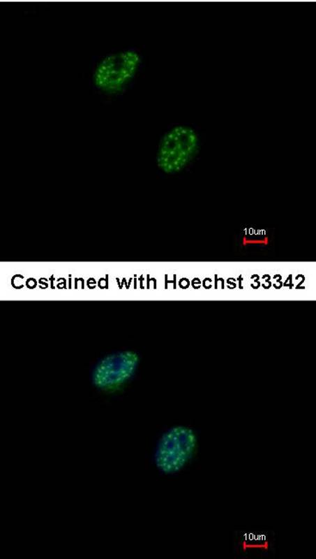 GABP-beta1 antibody