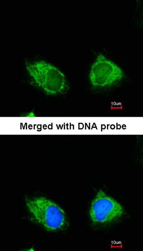 INPP1 antibody