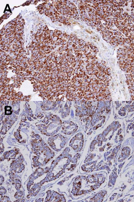 INPP1 antibody