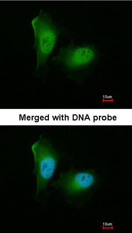 20S Proteasome alpha2 antibody