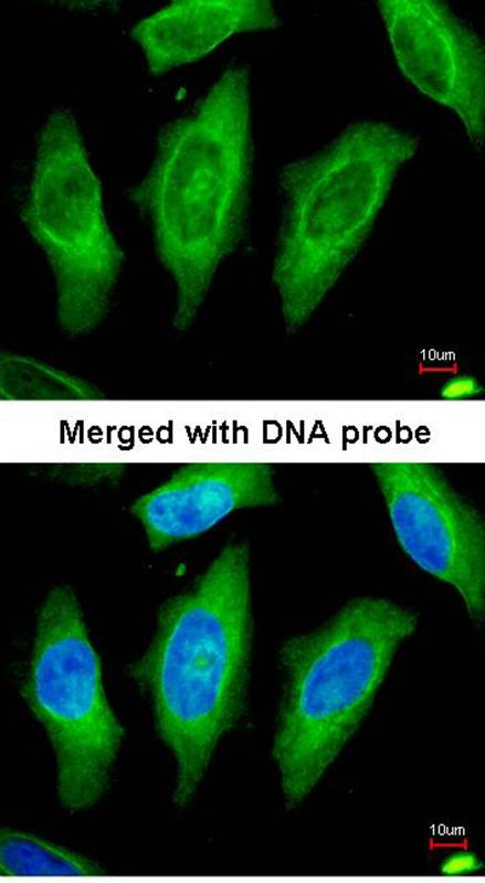 STK24 antibody