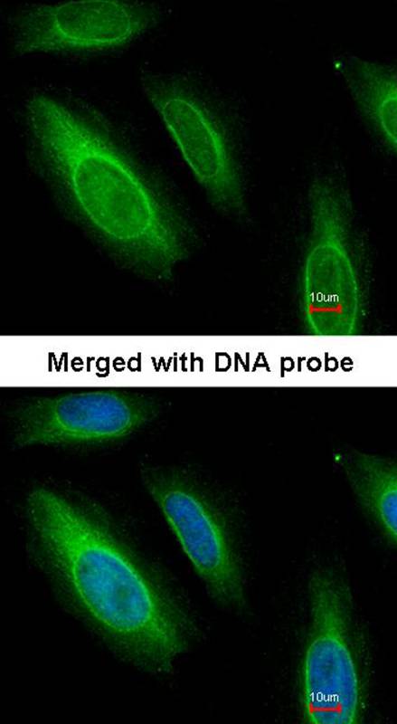 Argininosuccinate Lyase antibody