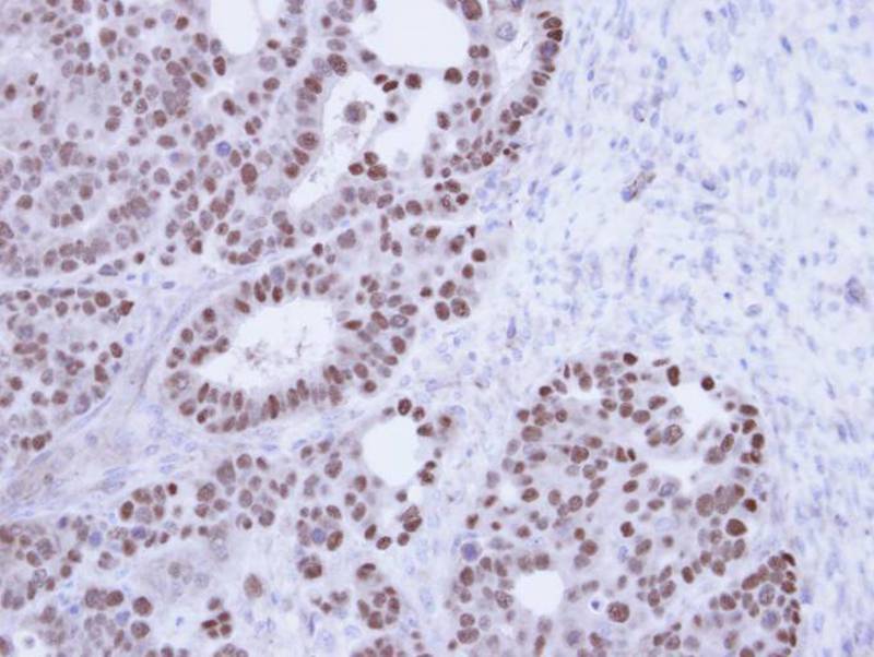 TAP antibody