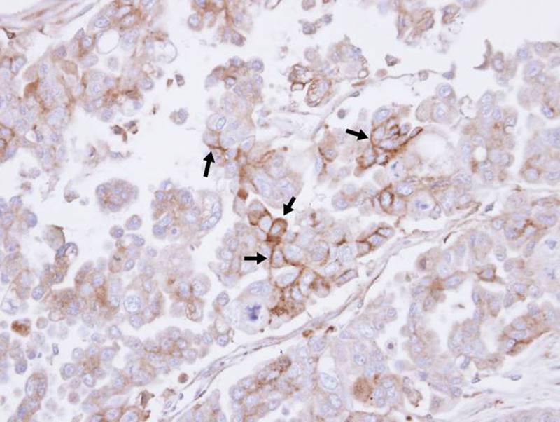 H-Ras antibody