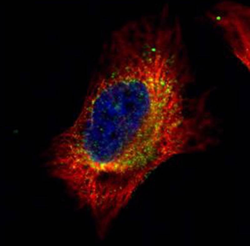 Cofilin 2 antibody